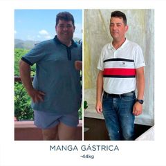 Manga gástrica - Clínica Londres