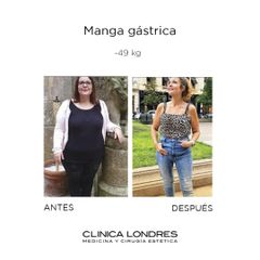 Manga gástrica