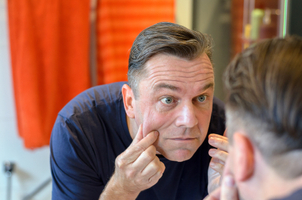 lifting facial